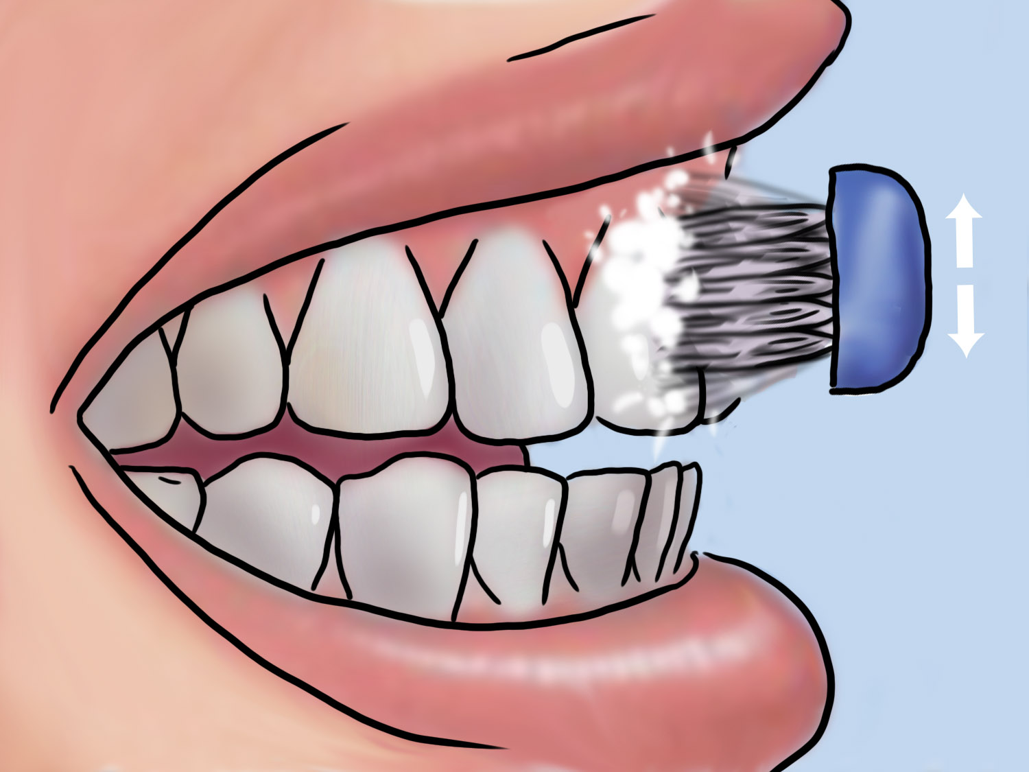 Ультразвуковая зубная щетка: плюсы и минусы | Семейная стоматология